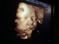 /album/mundo-ecografico/a2012-04-17-18-50-20-jpg/